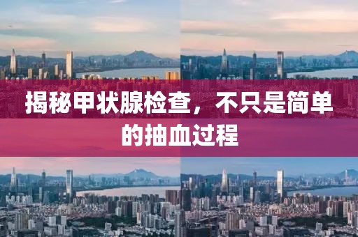 揭秘甲状腺检查，不只是简单的抽血过程