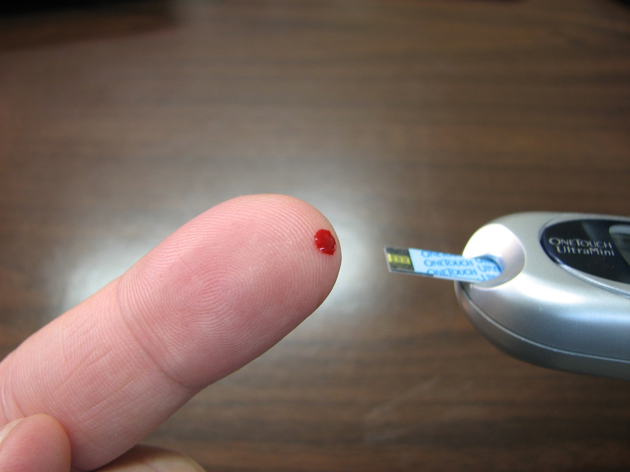 关于甲状腺功能检查是否需要空腹的疑问解答